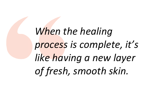 extract from the text about having a new layer of skin after microneedling
